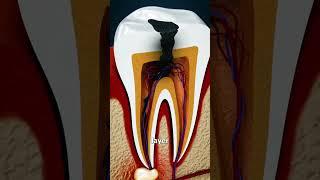 Why Grinding Your Teeth Is Bad 