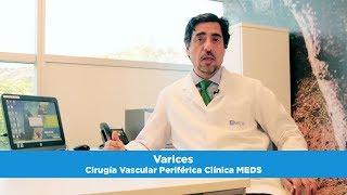 Varices  - Cirugía Vascular Periférica - Clínica MEDS