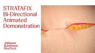 Animation of STRATAFIX Bi-directional Closure | J&J MedTech