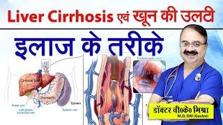 Liver Cirrhosis एव खून की उल्टी इलाज के तरीके || HOW IS CIRRHOSIS CAUSED BLEEDING TREATED