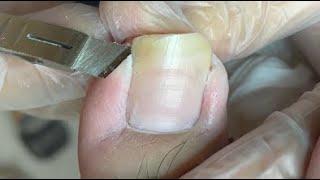 Satisfy long nail trimming skill