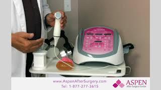 Ultrasound for Capsular Contracture or Capsular Contraction