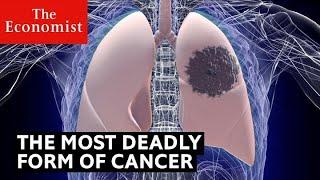 How to detect the deadliest form of cancer