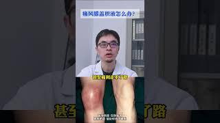 痛风膝盖积液怎么办？痛风 医学科普 痛风石