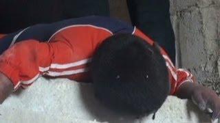 Horror after alleged chemical attack in Syria
