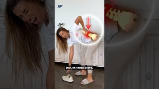 Exercise to Reverse Disc Herniation!