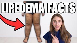 Lipedema Causes And Treatments Explained