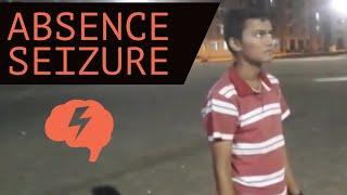 Absence seizure | Types of seizures | Epilepsy