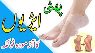 How to Get Rid of Heal Cracks in Summer & Winter (سردیوں، گرمیوں میں پھٹی ایڑیوں کا آزمودہ ٹوٹکہ)