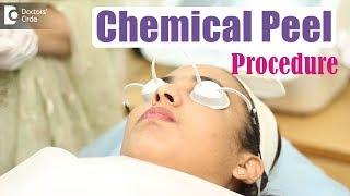 Chemical Peel Procedure | Dr. Divya Sharma| Doctors' Circle