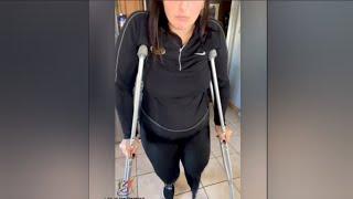 The beautiful woman with an amputated leg walking with crutches is a disability challenge #amputee