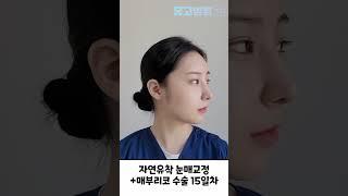 [휴고 성형외과] ️자연 유착 눈매교정 + 매부리코 성형️  #논현성형외과  #매부리코  #매부리코성형 #매부리코수술 #눈매교정 #눈성형 #눈성형잘하는곳 #자연유착 #전후사진