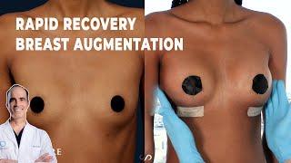 RAPID RECOVERY BREAST AUGMENTATION | 24 Hour Result | Dr. David Stoker