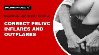 Treating Pelvic Inflare and Outflare with Myoskeletal Alignment Techniques| ErikDalton.com