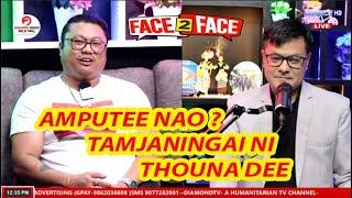 FACE 2 FACE WITH AMPUTEE NAO -MATOU KARAMNA ACCIDENT- PUNSHI WARI || 20th SEPT 2024 || DIAMOND TV