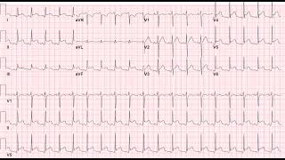 Pediatric Cardiology-I