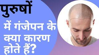 Male Pattern Baldness | Causes of Baldness | Alopecia Androgenética | Hair Restoration Treatment |