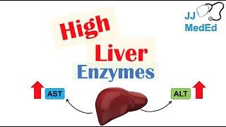 High Liver Enzymes | Aspartate vs Alanine Aminotransferase (AST vs. ALT) | Causes