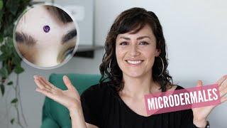 Microdermales: Todo lo que necesitas saber