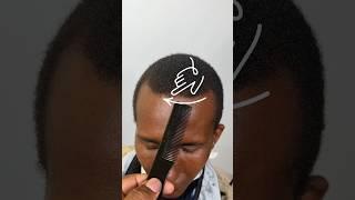 $100 Receding HAIRLINE Fix ‼️