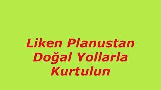 Liken Planus İçin Bitkisel ve Doğal Tedavi Yöntemleri