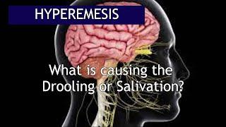 Hyperemesis: What causes the Excessive Salivation | Antai Hospital