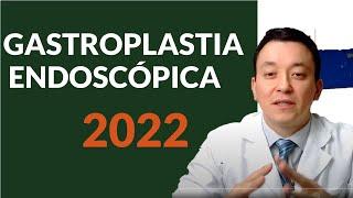 Gastroplastia Endoscópica | Como Funciona - *Atualizado 2022*