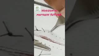 HORIZONTAL MATTRESS SUTURE