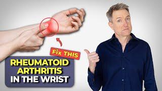 Rheumatoid Arthritis In The Wrist - How To Fix It