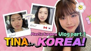 My plastic surgery story (PART1) | Facial contour, rhinoplasty, double eyelid surgery, facial lipo