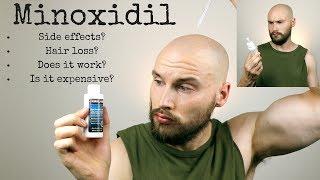 WHAT IS MINOXIDIL? Does it work? Should you use it?