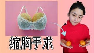 缩胸 | 我的缩胸手术分享， Breast Reduction Surgery Review