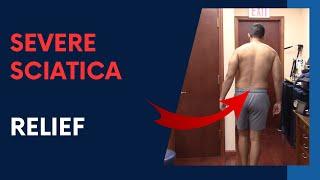 SEVERE Sciatica RELIEF by Dr Suh