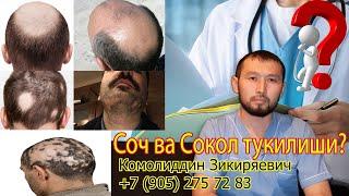 #Doktorspb Соч ва Сокол тукилиши сабаблари ? тизимли алопеция