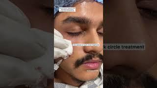 #dorasaiteja #haircare treatment at #hkpermanentmakeup clinic Hyde vijayawada 9052339052