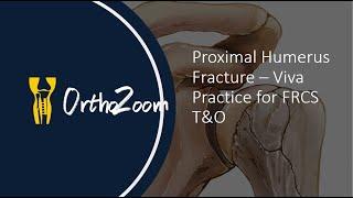 Proximal humerus fracture - viva practitce